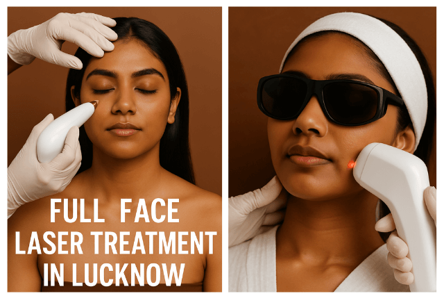 Lip Filler Treatment in Lucknow 